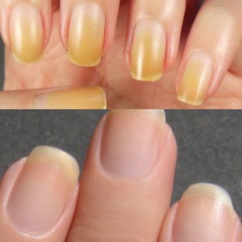 How to Whiten Your Nails