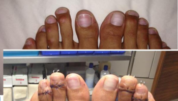 Crazy “Cinderella Surgery” Women Make