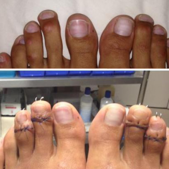 Crazy “Cinderella Surgery” Women Make