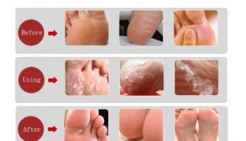 Get Soft Feet with This Efficient Method
