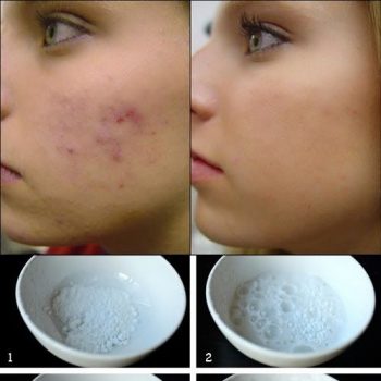 Smooth Skin Trick