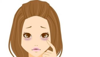 Amazing Beauty Tips to Remove Dark Circles