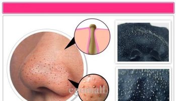 Blackheads Removing Mask