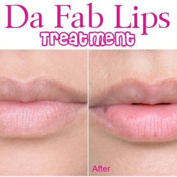 Treatment for Healthier Lips