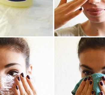 Efficient Blackheads Removing Method (2)
