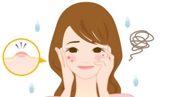 女性　ニキビ　湿疹　肌荒れ　冬
