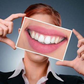 white-teeth