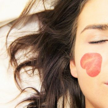 Skin-Needling-Treatment
