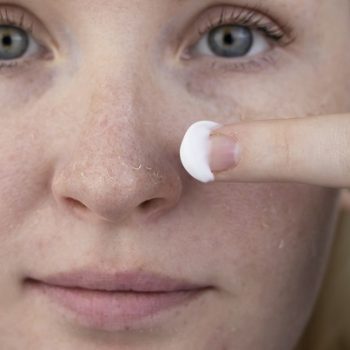 A woman examines dry skin on her face. Peeling, coarsening, disc