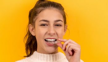 invisalign (2)